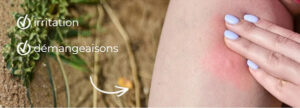 z-trauma-iritation-demangeaisons-bio